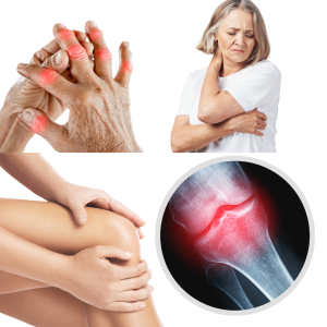 Joints and flexibility